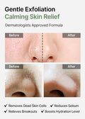 Celimax Ji Woo Gae Heartleaf BHA Peeling Pad 125Ml 60Pads