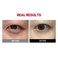 MediTherapy Wrinkle-Fit Tangle Eye Cream 20Ml