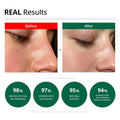 Dr. G R.E.D Blemish Clear Soothing Cream 70Ml
