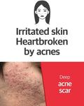 Some By Mi Snail Truecica Miracle Repair Toner 150Ml