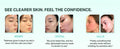 Bring Green Zinc Teca Blemish Serum 25Ml