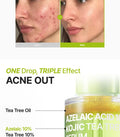 Purito Azelaic Acid 10 Kojic Tea Tree Serum 30Ml