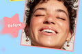 Mlsmile Smile Star Pimple Patches