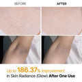 Dr.Melaxin Peel Shot Exfoliating Kojic Acid Turmeric Spray 200Ml