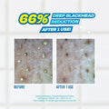 Jumiso Blackhead Melting Softener & Cotton Pad Special Kit