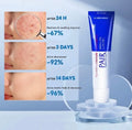 Lion Pair Acne Cream 14g