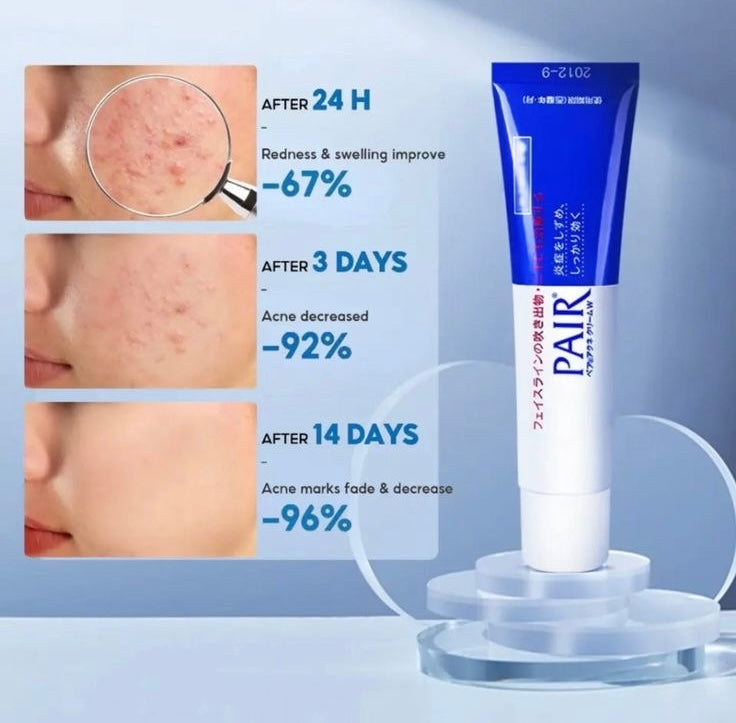 Lion Pair Acne Cream 14g