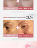 Medicube PDRN Pink Eye Cream 30M